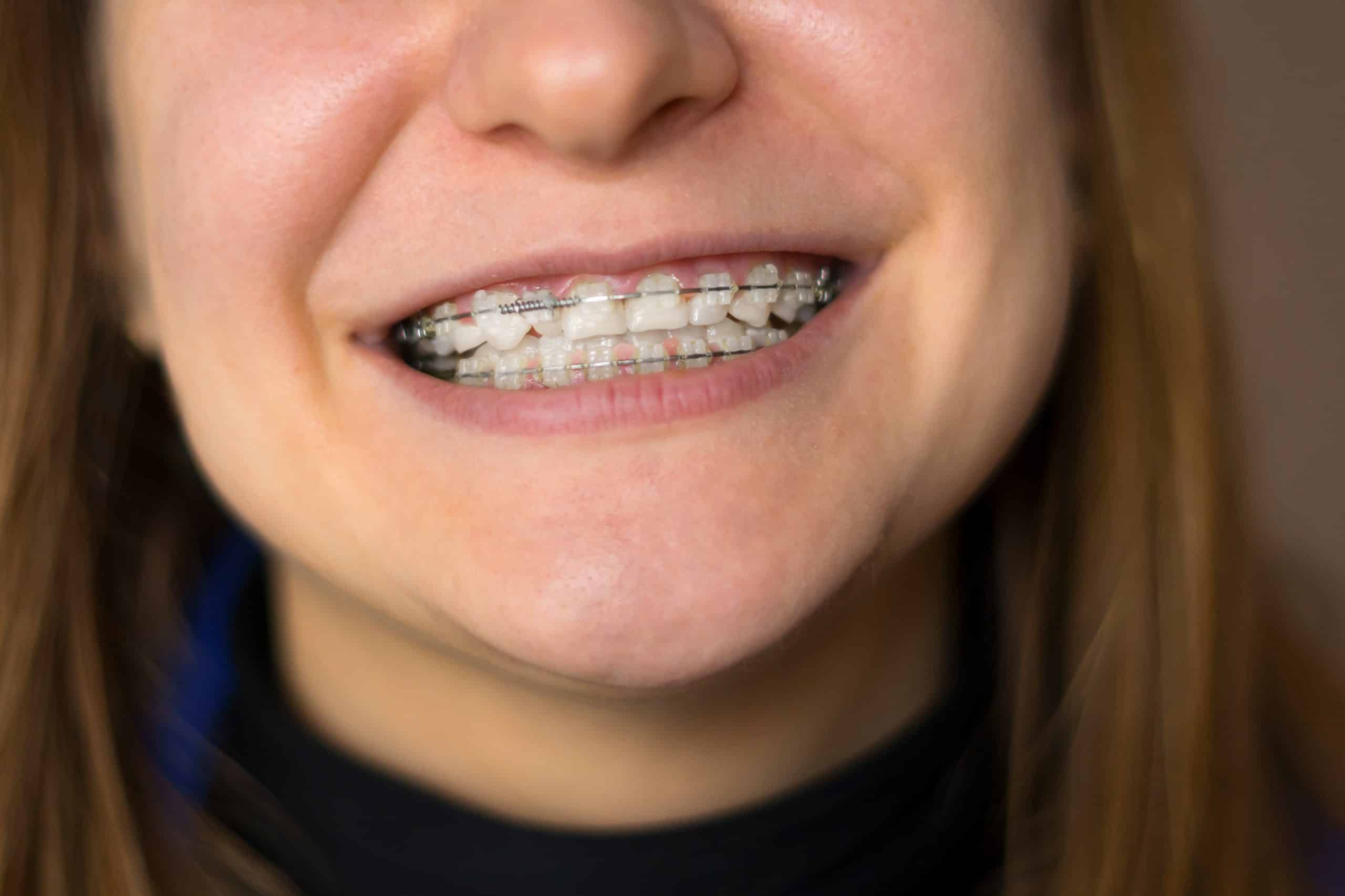 Featured image for “Orthodontist Arlington”